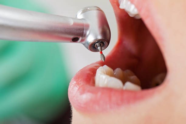 Best Tooth Infection Emergency Dentist  in Grafton, OH